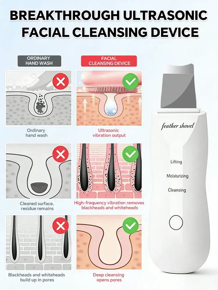 Ultrasonic Skin Scrubber – Facial Pore Cleaner & Exfoliating Device