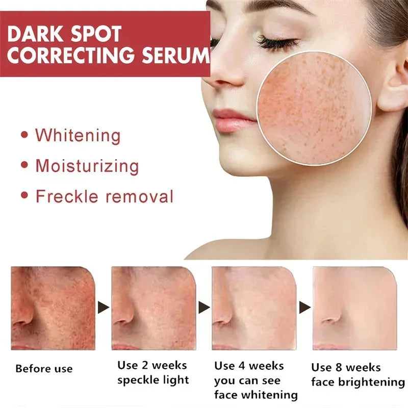 Dark Spots Remover Whitening Serum Face Freckle Melanin Correcting Reduce Fine Lines Brighten Essence Korean Beauty Skin Care