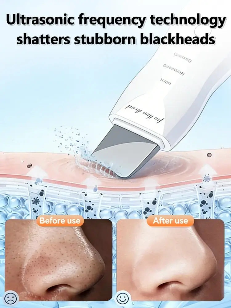 Ultrasonic Skin Scrubber – Facial Pore Cleaner & Exfoliating Device