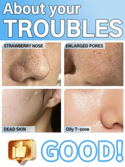 Ultrasonic Skin Scrubber – Facial Pore Cleaner & Exfoliating Device